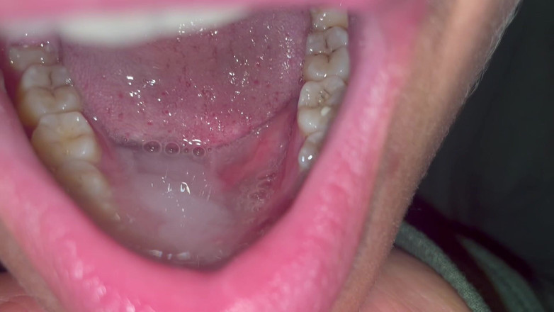 Ionut899: Tatăl Vitreg Mă Fute Rapid În Gură Să Îți Dea Drumul