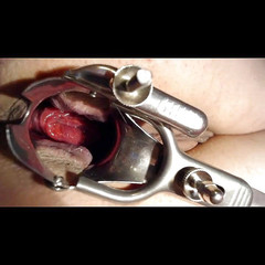 Putarankahotmilf: Spekulum dubur, prolaps, masukkan air ke dalam pantat dan pepek...