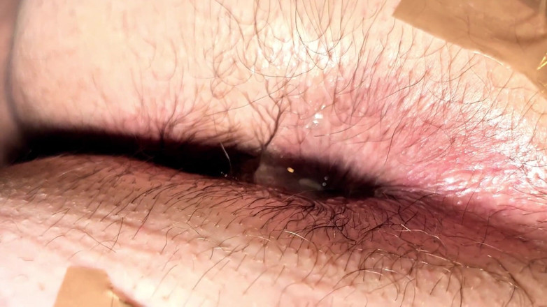 Ladybottox: Fill Hairy Anal Sex Creampie Close up Anal Hole
