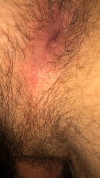 Hairy Twink Hole