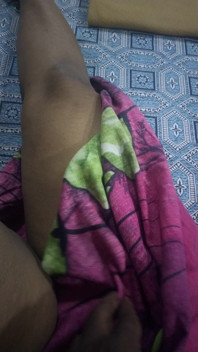 Hot Leg