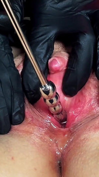Saiz kelentit penting bahagian 2: Bunyi ureteral