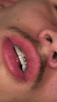 TYGA MELANCAP
