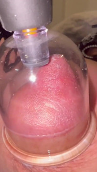 Nippelbechern teil 2