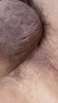 Fart Collection 13