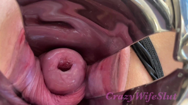 Crazywifeslut: Crazywifeslut Huge Speculum Play Fisting and Stretch