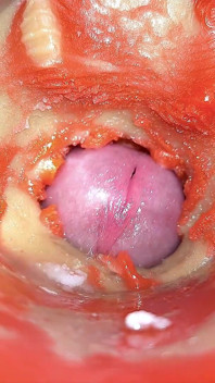 Kamera V análním Děložním Čípku POV, Drobný Paroháč Od Obřího 'páru', Mrdka V análu a Creampie - Asmr