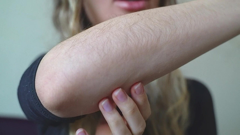 Rarible Diamond: 毛茸茸的前臂定制