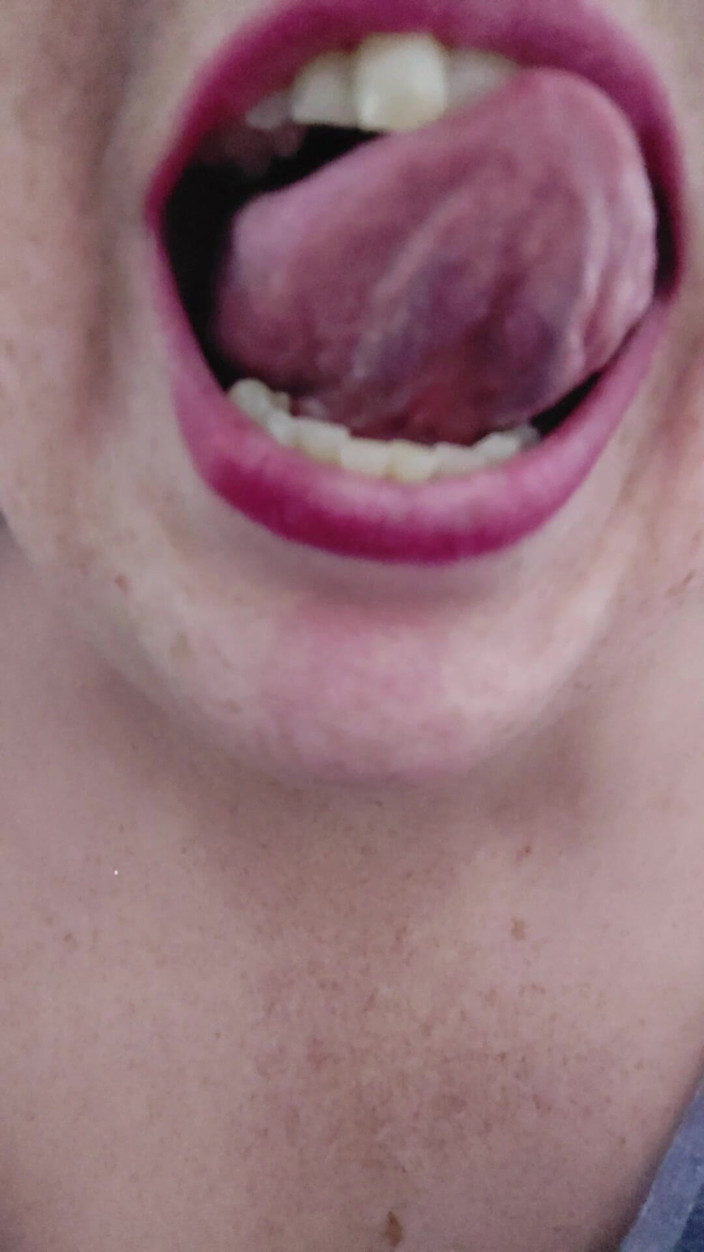 AngYourDirtyCanadian: Some Mouth Togue and Teeth