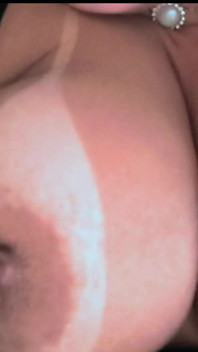 Nipples