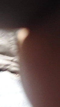 Protuberância Xl