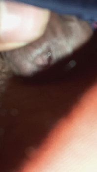 Super Anal