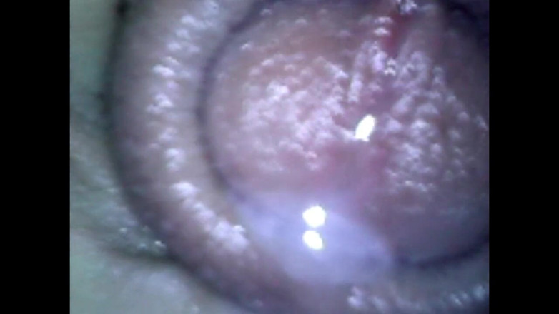 Idmir Sugary: Endoscope Details - Hole Balls Cock Foreskin Belly Nipples Mouth Sperm