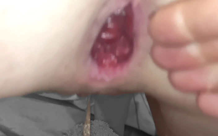 In Need of the Fist: Jag fick min 21f hora rövhålsstans knullad medan jag sprutade upprepade...