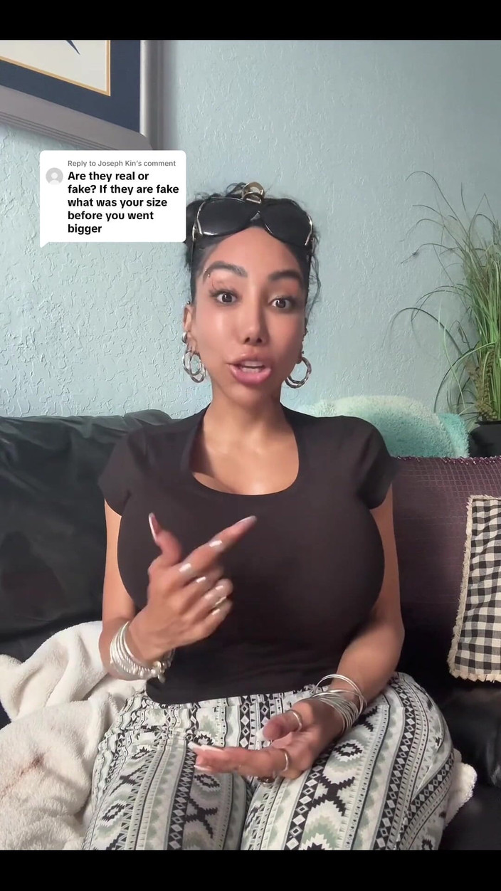 Anakaliyah: Just Wanna Share Some of My Plastic Surgery