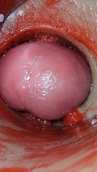 Kamera Di Dalam Pepek Mendalam Menangkap Pancutan Berlebihan – Pancutan Mani Sperma Asmr