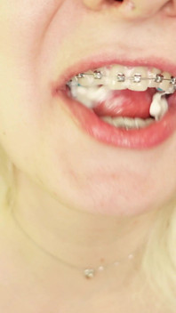 Eating in Braces, Food Fetish Video Devour