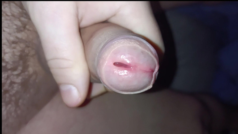 Uhri: Bermain dengan foreskin saya lapar