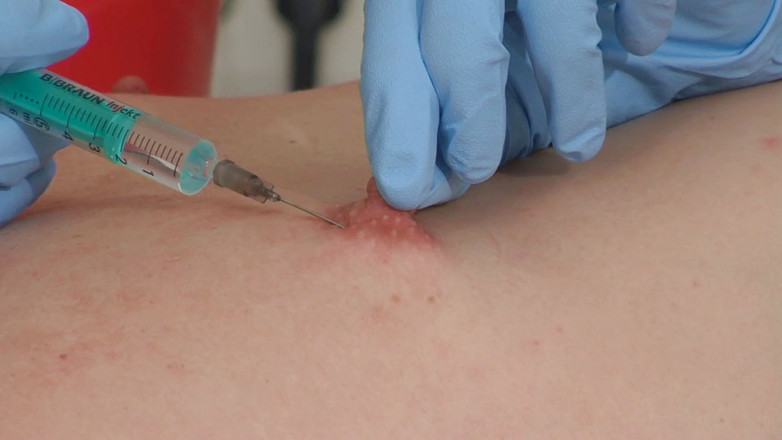 Rubber & Clinic Studio - 1ATOYS: 饥渴的乳头折磨