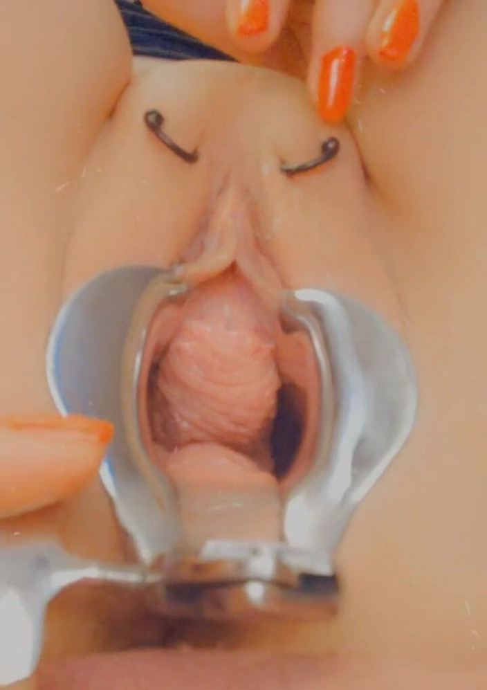SklavinS_pervert: 德国奴隶Sklavins新的尿洞奴隶训练!直到她的主人可以操她的尿道!!