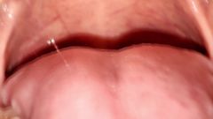 Princess18_: Permanente retainers mondtour