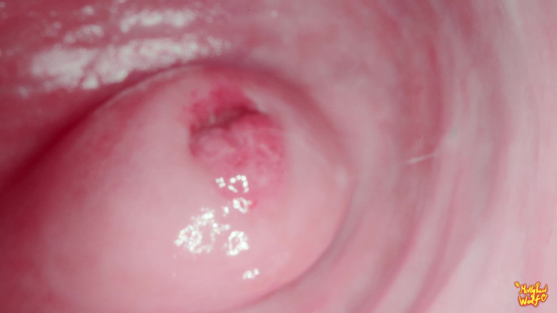 MollyRedWolf: Ei meio-irmão! Vamos brincar com o ginecologista? Ginecologista, Endoscopia - Mollyredwolf