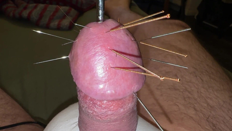 Qualzucht: Acupuncture - Orgasm!