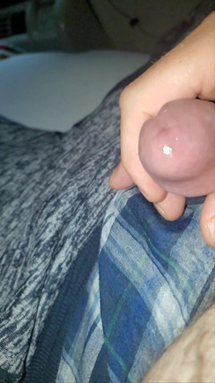 StickyStiltzDogg: Vlastní edging