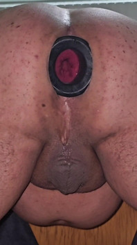 Huge Anal Opening.