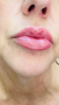 Sucking on a Lollipop! Yfm Likes Sweet Things in Her Mouth