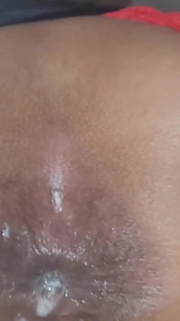 Trying to Get the Sperm Out, It Was so Deep That It Didn't Come Out