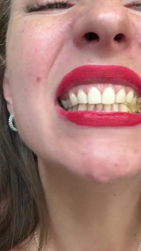 Wide Mouth Candy Crush Swallow