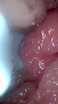 Panduan Visual Untuk Stimulasi G-Spot Dan Orgasme Endoscop Perspektif