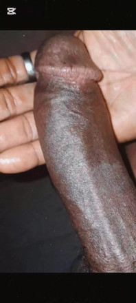 Blackpipe