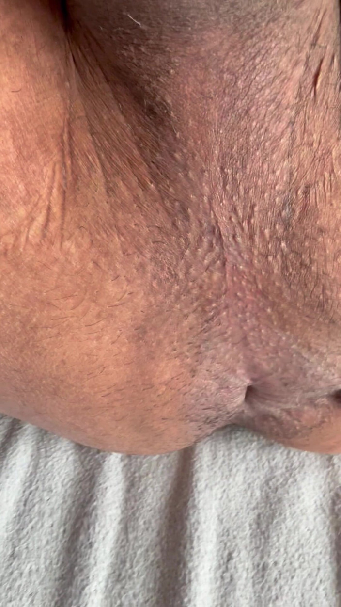 Aryan_for_ you: Une bite poilue se déshabille et se fait enculer