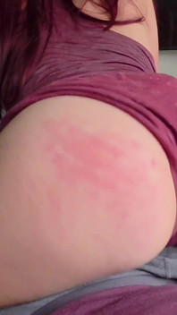 Ass Therapy with Redhead College Girl