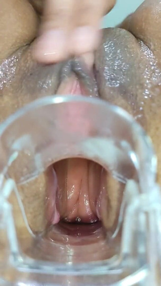 Xamy_97: Spekulum ile anal genişletme