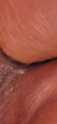Huge Asspussy Gape with Help From 9.5 in. Circumference King Cock Chubby!