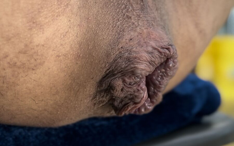 A Huge Asshole (Cock lover247)