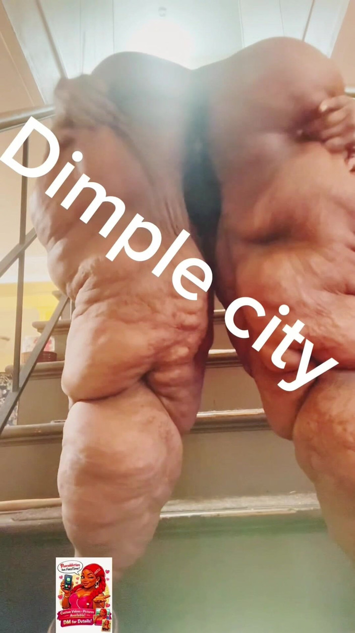 Pearaddiction: Ciudad de hoyuelos