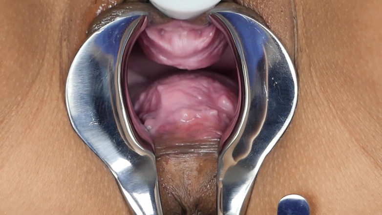 SexyThai1987: Speculum - podívejte se do mě hluboko