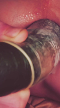 Dilatation Anal