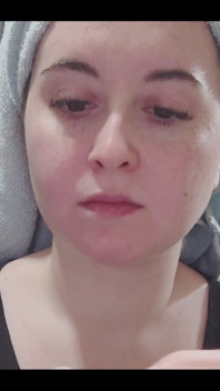 My ear cleaning routine starts with cotton swabs and then gauze.