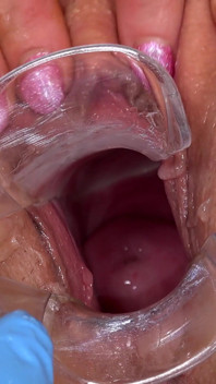 The Cervix of Daphne Klyde Is Exposed to the Whole World