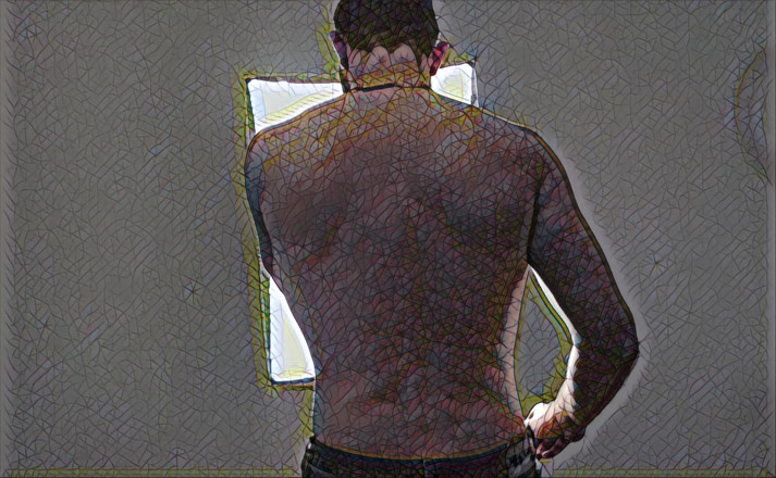 AlbinoAdonis: Striptiz Lütfen Serisi Halation