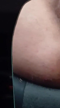 Anus XXX