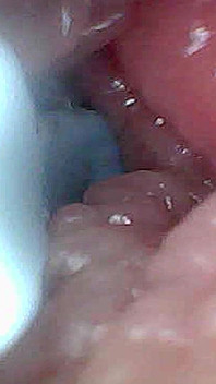 G Noktası Stimülasyonu ve Orgazm için Görsel Kılavuz - Endoskopik Perspektif