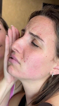Slap Face - Beating