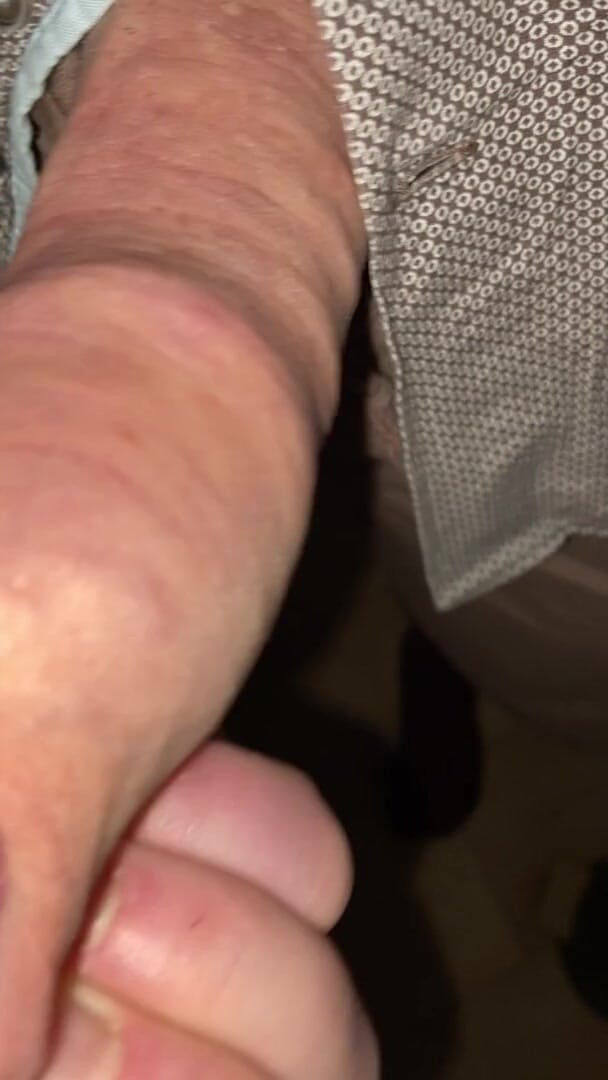 Foreskinguy: Oskuren spermasprut i sin egen förhud