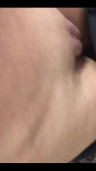 Someone Special Requested My Veins